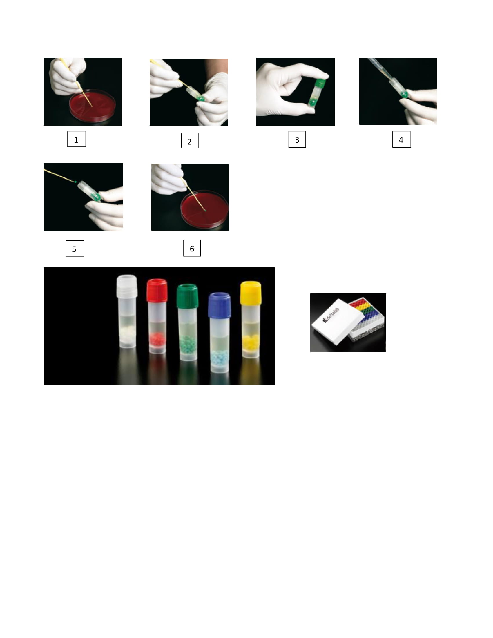 Cryoinstant: biluțe poroase pentru stocarea culturilor microbiologice